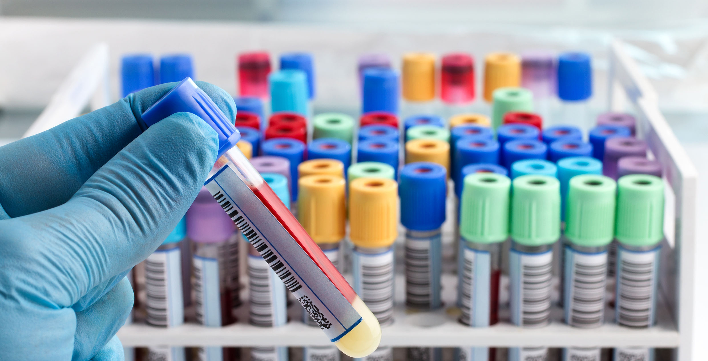 Lab beebe healthcare